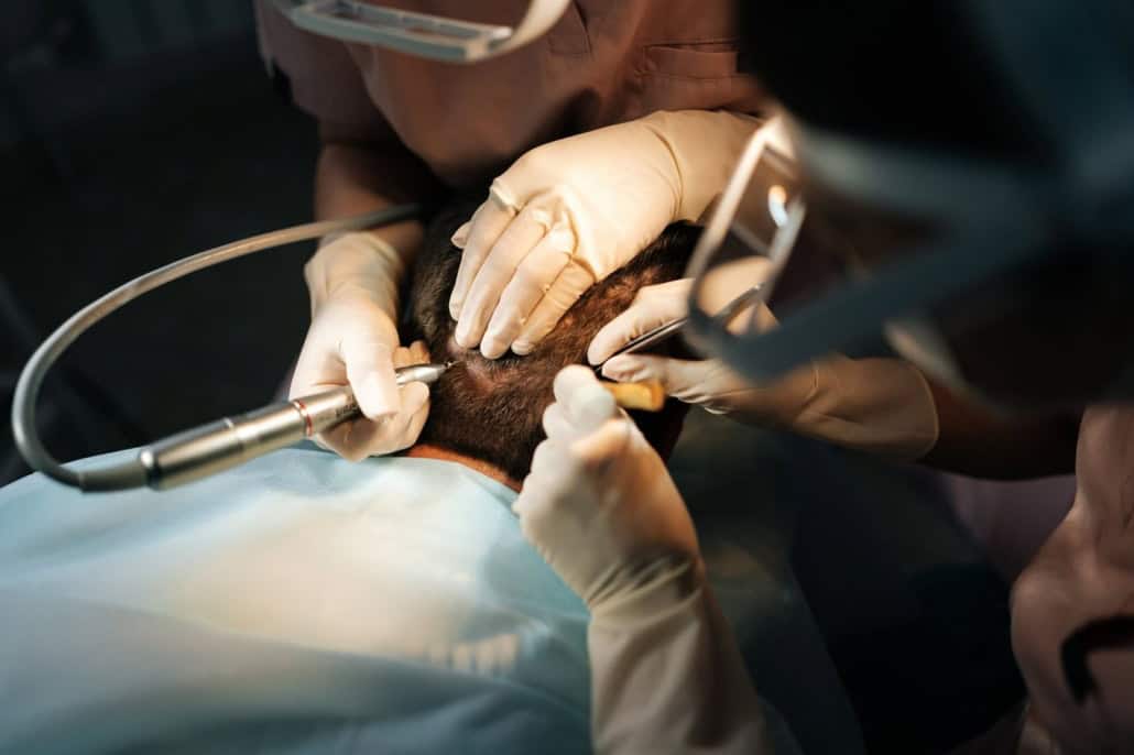 FUE hair transplant graft day: surgical team extracting follicular unit grafts from the donor area